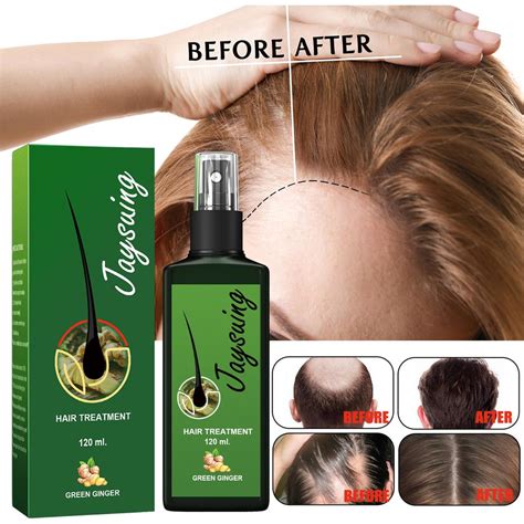 jaysuing hair roots treatment reviews